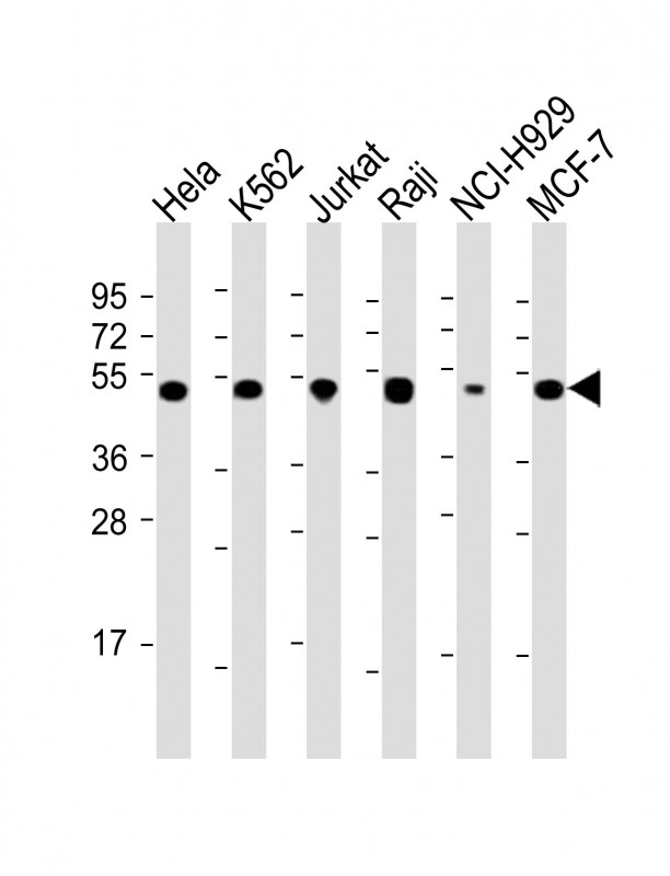 RPL4 / Ribosomal Protein L4 Antibody - All lanes: Anti-RPL4 Antibody (N-Term) at 1:2000 dilution Lane 1: Hela whole cell lysate Lane 2: K562 whole cell lysate Lane 3: Jurkat whole cell lysate Lane 4: Raji whole cell lysate Lane 5: NCI-H929 whole cell lysate Lane 6: MCF-7 whole cell lysate Lysates/proteins at 20 µg per lane. Secondary Goat Anti-Rabbit IgG, (H+L), Peroxidase conjugated at 1/10000 dilution. Predicted band size: 48 kDa Blocking/Dilution buffer: 5% NFDM/TBST.