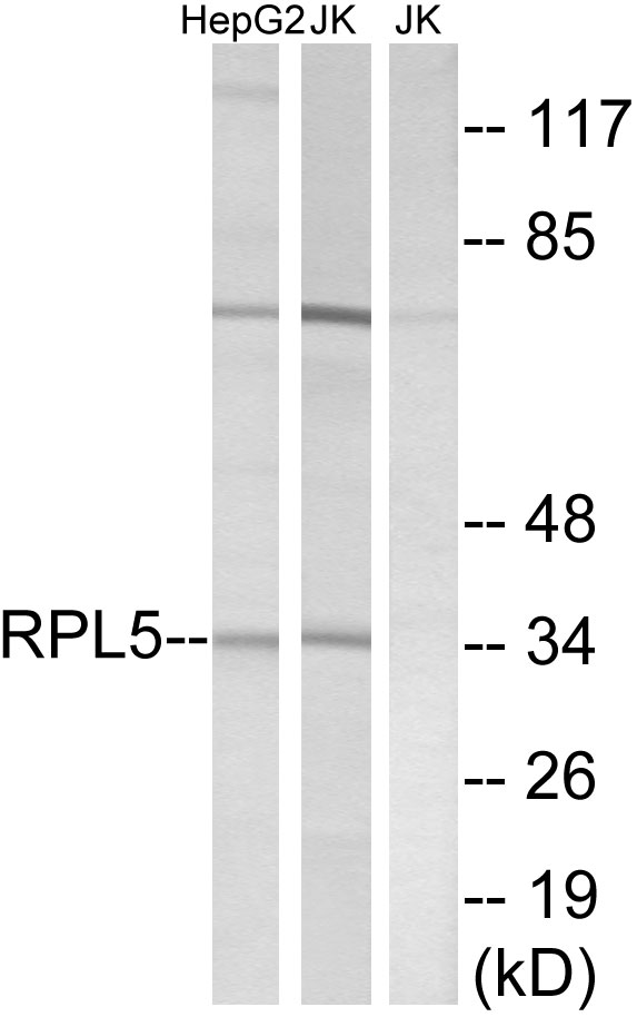 RPL5 / Ribosomal Protein L5 Antibody - Western blot analysis of lysates from Jurkat and HepG2 cells, using RPL5 Antibody. The lane on the right is blocked with the synthesized peptide.