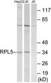 RPL5 / Ribosomal Protein L5 Antibody - Western blot analysis of lysates from Jurkat and HepG2 cells, using RPL5 Antibody. The lane on the right is blocked with the synthesized peptide.