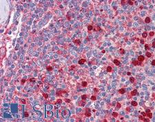 RPL5 / Ribosomal Protein L5 Antibody - Anti-RPL5 antibody IHC of human spleen. Immunohistochemistry of formalin-fixed, paraffin-embedded tissue after heat-induced antigen retrieval. Antibody concentration 5 ug/ml.  This image was taken for the unconjugated form of this product. Other forms have not been tested.