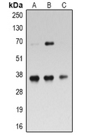 RPL5 / Ribosomal Protein L5 Antibody - Western blot analysis of RPL5 expression in HeLa (A); Jurkat (B); MOLT4 (C) whole cell lysates.