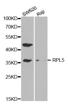 RPL5 / Ribosomal Protein L5 Antibody - Western blot analysis of extracts of various cell lines.