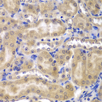 RPL5 / Ribosomal Protein L5 Antibody - Immunohistochemistry of paraffin-embedded mouse kidney tissue.