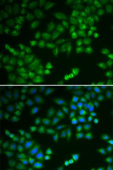 RPL5 / Ribosomal Protein L5 Antibody - Immunofluorescence analysis of MCF-7 cells.