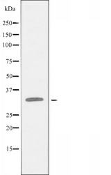 RPL5 / Ribosomal Protein L5 Antibody - Western blot analysis of extracts of HepG2 cells using RPL5 antibody.