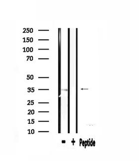 RPL5 / Ribosomal Protein L5 Antibody - Western blot analysis of extracts of mouse spleen using RPL5 antibody.