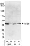 RPL6 / Ribosomal Protein L6 Antibody - Detection of Human RPL6 by Western Blot. Samples: Whole cell lysate from 293T (15 and 50 ug), HeLa (H; 50 ug) and Jurkat (J; 50 ug) cells. Antibodies: Affinity purified rabbit anti-RPL6 antibody used for WB at 0.04 ug/ml. Detection: Chemiluminescence with an exposure time of 30 seconds.
