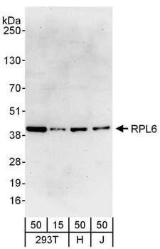 RPL6 / Ribosomal Protein L6 Antibody - Detection of Human RPL6 by Western Blot. Samples: Whole cell lysate from 293T (15 and 50 ug), HeLa (H; 50 ug) and Jurkat (J; 50 ug) cells. Antibodies: Affinity purified rabbit anti-RPL6 antibody used for WB at 0.04 ug/ml. Detection: Chemiluminescence with an exposure time of 30 seconds.