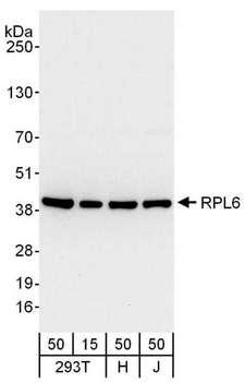 RPL6 / Ribosomal Protein L6 Antibody - Detection of Human RPL6 by Western Blot. Samples: Whole cell lysate from 293T (15 and 50 ug), HeLa (H; 50 ug) and Jurkat (J; 50 ug) cells. Antibodies: Affinity purified rabbit anti-RPL6 antibody used for WB at 0.04 ug/ml. Detection: Chemiluminescence with an exposure time of 10 seconds.