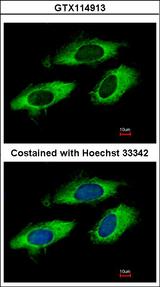 RPL6 / Ribosomal Protein L6 Antibody - Immunofluorescence of methanol-fixed HeLa, using RPL6 antibody at 1:500 dilution.