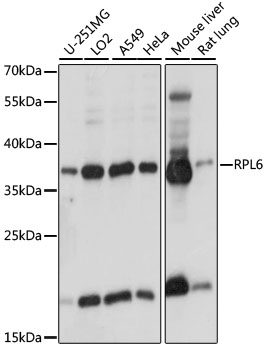 RPL6 / Ribosomal Protein L6 Antibody - Western blot analysis of extracts of various cell lines, using RPL6 antibody at 1:1000 dilution. The secondary antibody used was an HRP Goat Anti-Rabbit IgG (H+L) at 1:10000 dilution. Lysates were loaded 25ug per lane and 3% nonfat dry milk in TBST was used for blocking. An ECL Kit was used for detection and the exposure time was 1s.