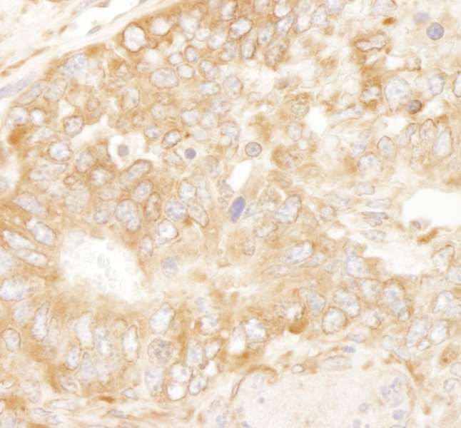 RPL7 / Ribosomal Protein L7 Antibody - Detection of Mouse RPL7 by Immunohistochemistry. Sample: FFPE section of mouse teratoma. Antibody: Affinity purified rabbit anti-RPL7 used at a dilution of 1:100. Epitope Retrieval Buffer-High pH (IHC-101J) was substituted for Epitope Retrieval Buffer-Reduced pH.