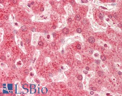 RPL7 / Ribosomal Protein L7 Antibody - Human Liver: Formalin-Fixed, Paraffin-Embedded (FFPE).  This image was taken for the unconjugated form of this product. Other forms have not been tested.