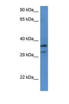 RPL7 / Ribosomal Protein L7 Antibody - RPL7 antibody western blot of HeLa Cell lysate. Antibody concentration 1 ug/ml.  This image was taken for the unconjugated form of this product. Other forms have not been tested.