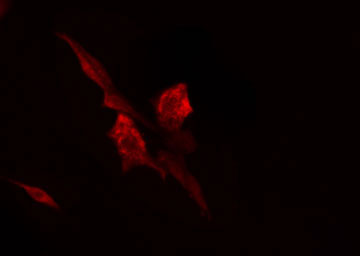RPL7 / Ribosomal Protein L7 Antibody - Staining 293 cells by IF/ICC. The samples were fixed with PFA and permeabilized in 0.1% Triton X-100, then blocked in 10% serum for 45 min at 25°C. The primary antibody was diluted at 1:200 and incubated with the sample for 1 hour at 37°C. An Alexa Fluor 594 conjugated goat anti-rabbit IgG (H+L) antibody, diluted at 1/600, was used as secondary antibody.