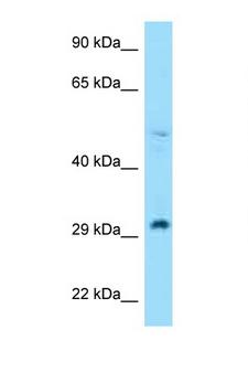 RPL7 / Ribosomal Protein L7 Antibody - RPL7 antibody Western blot of H226 Cell lysate. Antibody concentration 1 ug/ml.  This image was taken for the unconjugated form of this product. Other forms have not been tested.