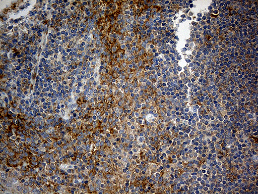 RPL7A / Ribosomal Protein L7a Antibody - Immunohistochemical staining of paraffin-embedded Human tonsil within the normal limits using anti-RPL7A mouse monoclonal antibody. (Heat-induced epitope retrieval by 1mM EDTA in 10mM Tris buffer. (pH8.5) at 120°C for 3 min. (1:500)