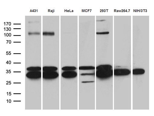 RPL7A / Ribosomal Protein L7a Antibody - Western blot analysis of extracts. (35ug) from 7 different cell lines by using anti-RPL7A monoclonal antibody. (1:500)