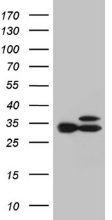 RPL7A / Ribosomal Protein L7a Antibody - HEK293T cells were transfected with the pCMV6-ENTRY control. (Left lane) or pCMV6-ENTRY RPL7A. (Right lane) cDNA for 48 hrs and lysed. Equivalent amounts of cell lysates. (5 ug per lane) were separated by SDS-PAGE and immunoblotted with anti-RPL7A. (1:2000)