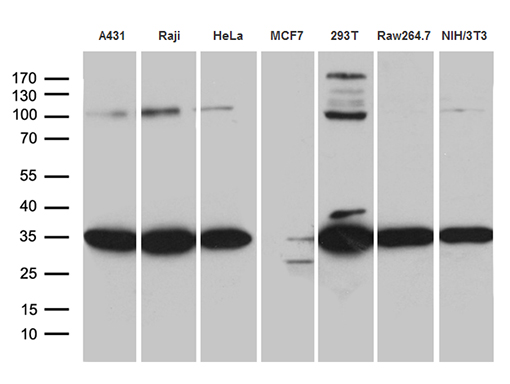 RPL7A / Ribosomal Protein L7a Antibody - Western blot analysis of extracts. (35ug) from 7 different cell lines by using anti-RPL7A monoclonal antibody. (1:500)
