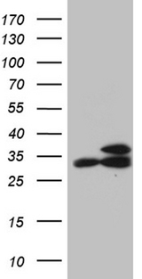 RPL7A / Ribosomal Protein L7a Antibody - HEK293T cells were transfected with the pCMV6-ENTRY control. (Left lane) or pCMV6-ENTRY RPL7A. (Right lane) cDNA for 48 hrs and lysed
