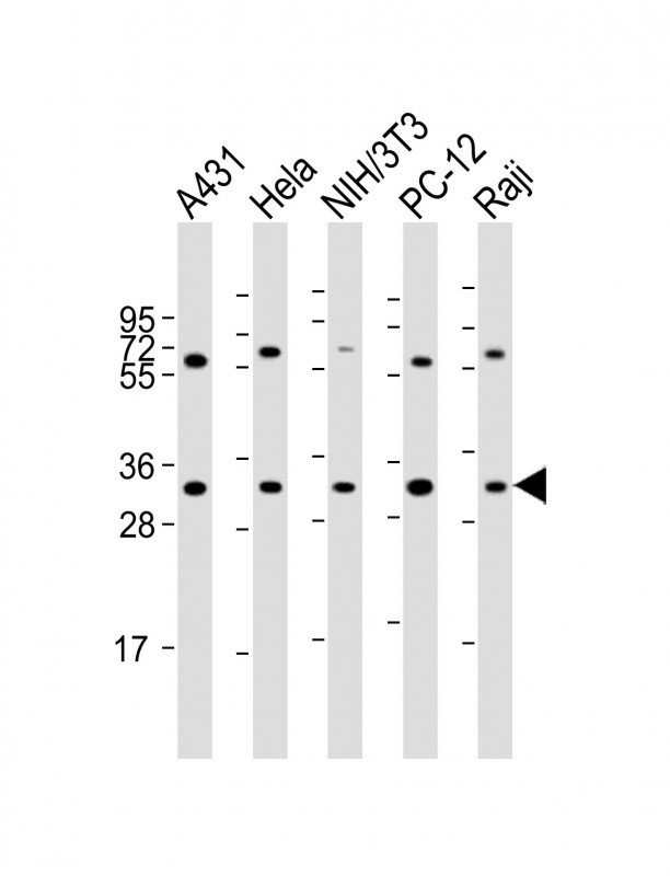 RPL7A / Ribosomal Protein L7a Antibody - All lanes: Anti-RPL7A Antibody (C-Term) at 1:2000 dilution. Lane 1: A431 whole cell lysate. Lane 2: HeLa whole cell lysate. Lane 3: NIH/3T3 whole cell lysate. Lane 4: PC-12 whole cell lysate. Lane 5: Raji whole cell lysate Lysates/proteins at 20 ug per lane. Secondary Goat Anti-Rabbit IgG, (H+L), Peroxidase conjugated at 1:10000 dilution. Predicted band size: 30 kDa. Blocking/Dilution buffer: 5% NFDM/TBST.