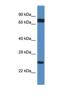 RPL7A / Ribosomal Protein L7a Antibody - RPL7A antibody Western blot of 293T Cell lysate. Antibody concentration 1 ug/ml.  This image was taken for the unconjugated form of this product. Other forms have not been tested.