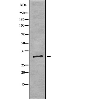 RPL7A / Ribosomal Protein L7a Antibody - Western blot analysis of RPL7A using K562 whole cells lysates