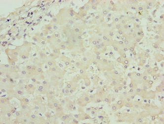 RPL7L1 Antibody - Immunohistochemistry of paraffin-embedded human liver tissue using RPL7L1 Antibody at dilution of 1:100