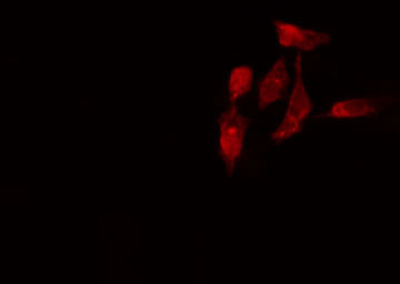 RPL7L1 Antibody - Staining HepG2 cells by IF/ICC. The samples were fixed with PFA and permeabilized in 0.1% Triton X-100, then blocked in 10% serum for 45 min at 25°C. The primary antibody was diluted at 1:200 and incubated with the sample for 1 hour at 37°C. An Alexa Fluor 594 conjugated goat anti-rabbit IgG (H+L) antibody, diluted at 1/600, was used as secondary antibody.