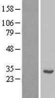 RPL7L1 Protein - Western validation with an anti-DDK antibody * L: Control HEK293 lysate R: Over-expression lysate