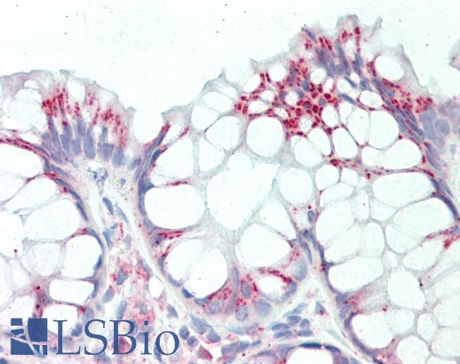 RPL8 / Ribosomal Protein L8 Antibody - Anti-RPL8 / L8 antibody IHC staining of human colon. Immunohistochemistry of formalin-fixed, paraffin-embedded tissue after heat-induced antigen retrieval. Antibody concentration 10 ug/ml.  This image was taken for the unconjugated form of this product. Other forms have not been tested.