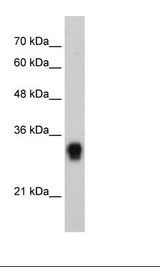 RPL8 / Ribosomal Protein L8 Antibody - HepG2 Cell Lysate.  This image was taken for the unconjugated form of this product. Other forms have not been tested.