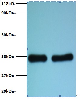 RPL8 / Ribosomal Protein L8 Antibody - Western blot of 60S ribosomal protein L8 antibody at 2 ug/ml. Lane 1: EC109 whole cell lysate. Lane 2: 293T whole cell lysate. Predicted band size: 28 kDa. Observed band size: 35 kDa.  This image was taken for the unconjugated form of this product. Other forms have not been tested.