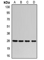 RPL8 / Ribosomal Protein L8 Antibody