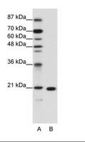 RPL9 / Ribosomal Protein L9 Antibody - A: Marker, B: Jurkat Cell Lysate.  This image was taken for the unconjugated form of this product. Other forms have not been tested.