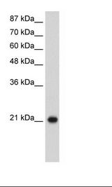 RPL9 / Ribosomal Protein L9 Antibody - Jurkat Cell Lysate.  This image was taken for the unconjugated form of this product. Other forms have not been tested.