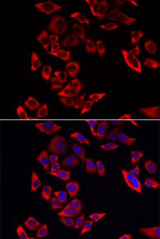 RPL9 / Ribosomal Protein L9 Antibody - Immunofluorescence analysis of MCF-7 cells.