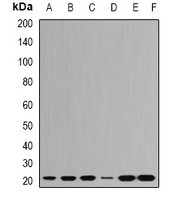 RPL9 / Ribosomal Protein L9 Antibody - Western blot analysis of RPL9 expression in HeLa (A); HepG2 (B); SHSY5Y (C); Jurkat (D); mouse brain (E); mouse spleen (F) whole cell lysates.