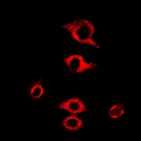 RPL9 / Ribosomal Protein L9 Antibody - Immunofluorescent analysis of RPL9 staining in MCF7 cells. Formalin-fixed cells were permeabilized with 0.1% Triton X-100 in TBS for 5-10 minutes and blocked with 3% BSA-PBS for 30 minutes at room temperature. Cells were probed with the primary antibody in 3% BSA-PBS and incubated overnight at 4 deg C in a humidified chamber. Cells were washed with PBST and incubated with a DyLight 594-conjugated secondary antibody (red) in PBS at room temperature in the dark.