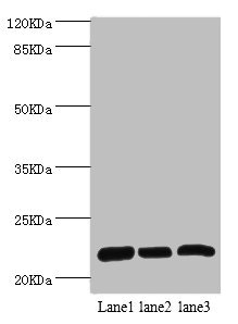 RPL9 / Ribosomal Protein L9 Antibody - Western blot All Lanes:RPL9 antibody at 0.61ug/ml Lane 1:SY-5Y whole cell lysate Lane 2:Hela whole cell lysate Lane 3:HepG2 whole cell lysate Secondary Goat polyclonal to rabbit at 1/10000 dilution Predicted band size: 22kDa Observed band size: 22kDa