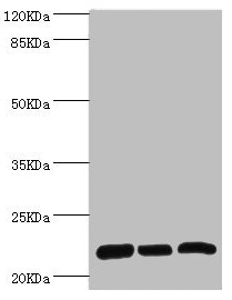 RPL9 / Ribosomal Protein L9 Antibody - Western blot All lanes: RPL9 antibody at 0.61µg/ml Lane 1: SY-5Y whole cell lysate Lane 2: Hela whole cell lysate Lane 3: HepG2 whole cell lysate Secondary Goat polyclonal to rabbit IgG at 1/10000 dilution Predicted band size: 22 kDa Observed band size: 22 kDa