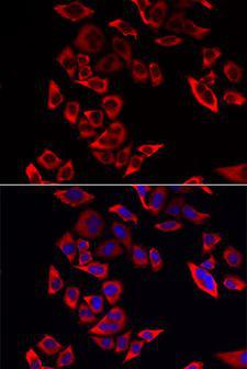 RPL9 / Ribosomal Protein L9 Antibody - Immunofluorescence analysis of MCF-7 cells using RPL9 antibody. Blue: DAPI for nuclear staining.