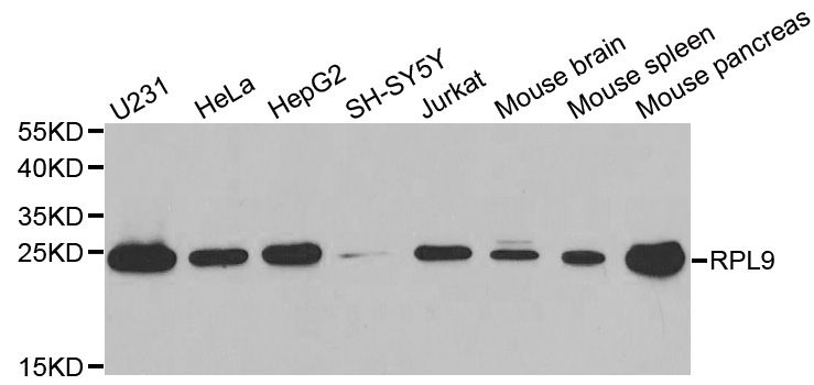RPL9 / Ribosomal Protein L9 Antibody - Western blot analysis of extracts of various cell lines, using RPL9 antibody at 1:1000 dilution. The secondary antibody used was an HRP Goat Anti-Rabbit IgG (H+L) at 1:10000 dilution. Lysates were loaded 25ug per lane and 3% nonfat dry milk in TBST was used for blocking. An ECL Kit was used for detection and the exposure time was 90s.
