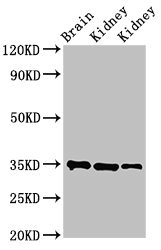 RPLP0 Antibody - Western Blot Positive WB detected in: Rat brain tissue, Rat kidney tissue, Mouse kidney tissue All lanes: RPLP0 antibody at 3.4µg/ml Secondary Goat polyclonal to rabbit IgG at 1/50000 dilution Predicted band size: 35, 28 kDa Observed band size: 35 kDa
