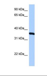 RPLP0 Antibody - HepG2 cell lysate. Antibody concentration: 0.5 ug/ml. Gel concentration: 12%.  This image was taken for the unconjugated form of this product. Other forms have not been tested.
