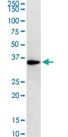 RPLP0 Antibody - RPLP0 monoclonal antibody (M01), clone 1B4. Western Blot analysis of RPLP0 expression in HeLa.