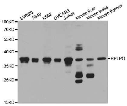 RPLP0 Antibody - Western blot analysis of extracts of various cell lines, using RPLP0 antibody.