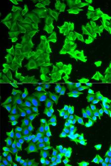 RPLP0 Antibody - Immunofluorescence analysis of HeLa cell using RPLP0 antibody. Blue: DAPI for nuclear staining.
