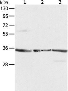 RPLP0 Antibody - Western blot analysis of NIH/3T3, A431 and Jurkat cell, using RPLP0 Polyclonal Antibody at dilution of 1:750.
